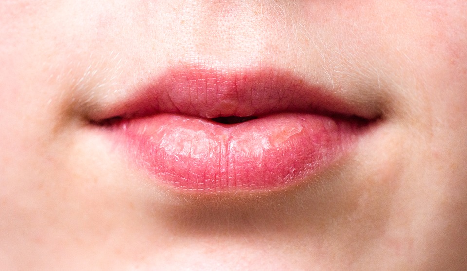penyebab bibir kering