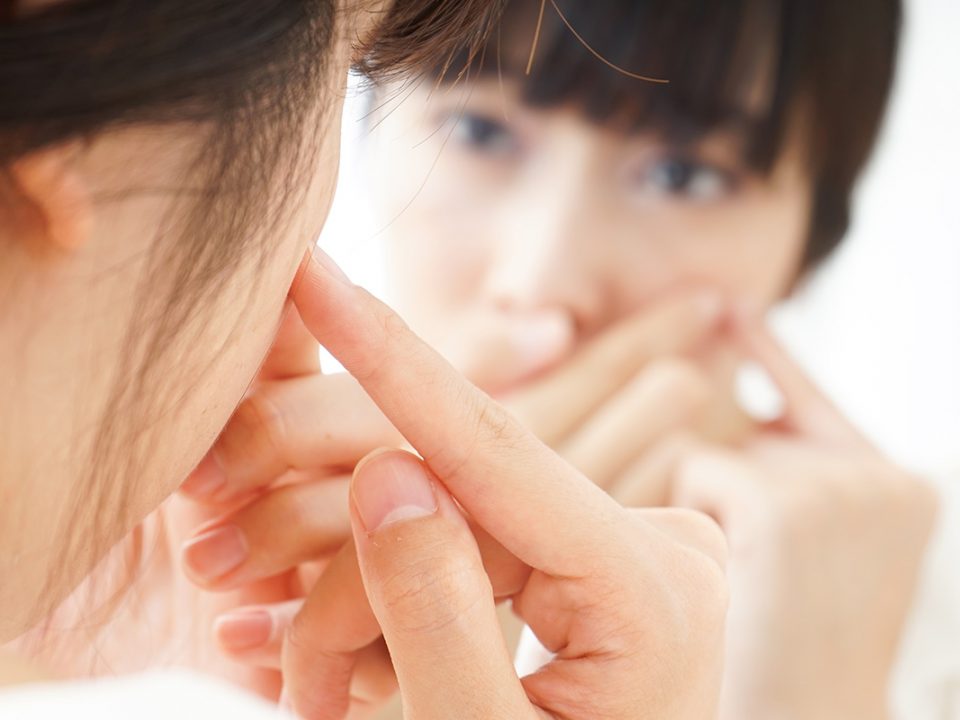 Cara menyamarkan jerawat dengan makeup
