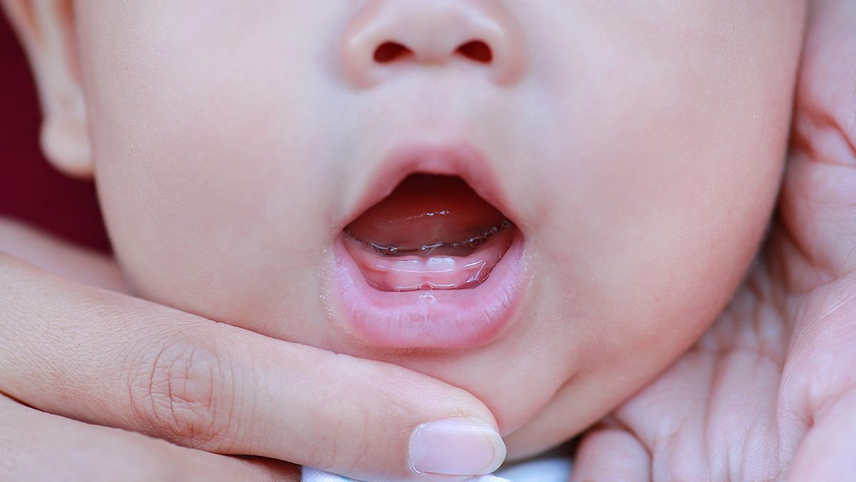 Bayi tumbuh gigi