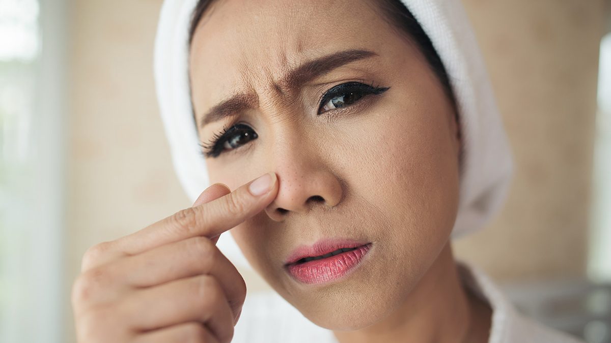 Menghilangkan komedo