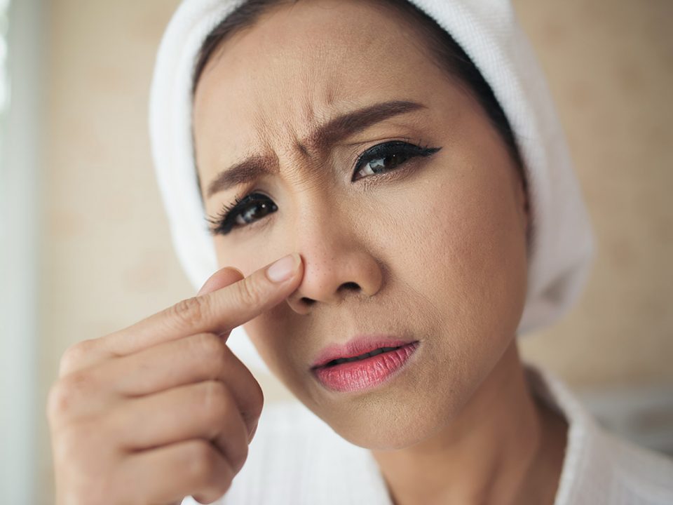 Menghilangkan komedo