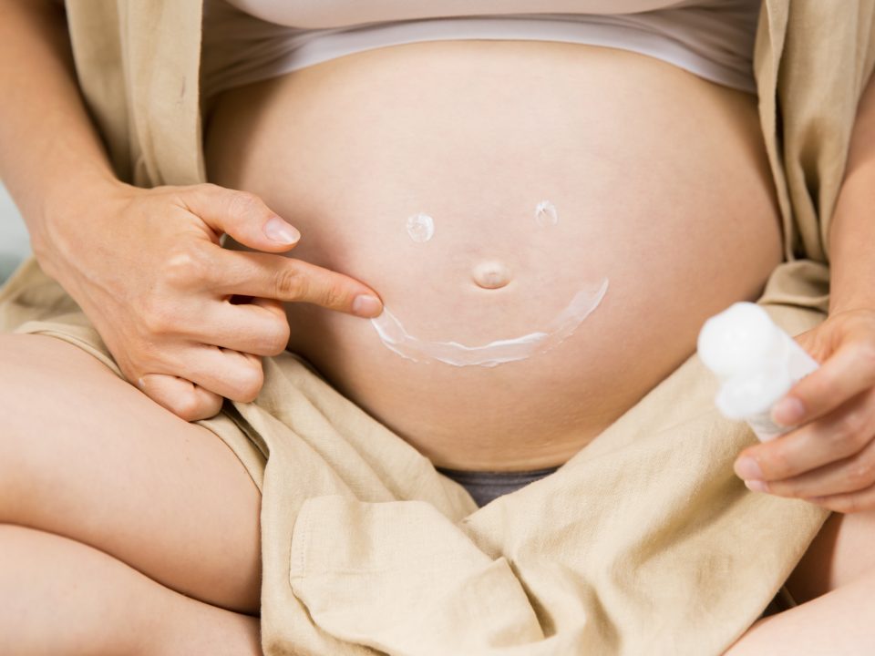 Menghilangkan stretch mark