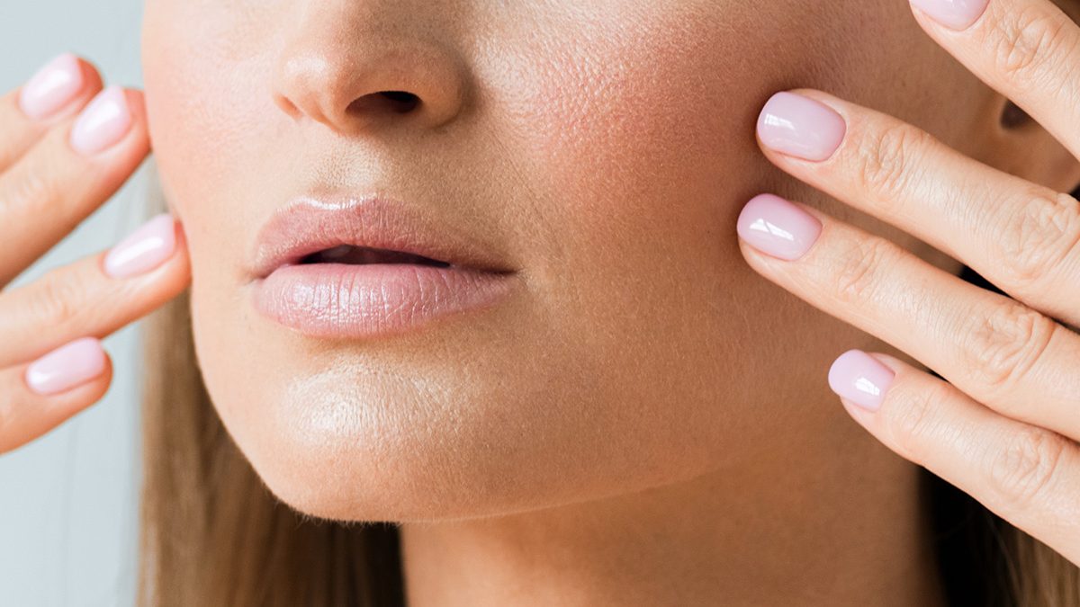 Skin Barrier Rusak