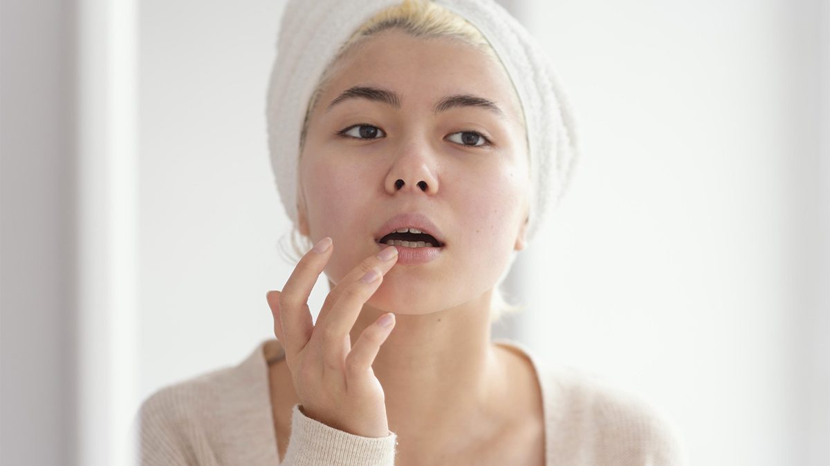Cara Menipiskan Bibir