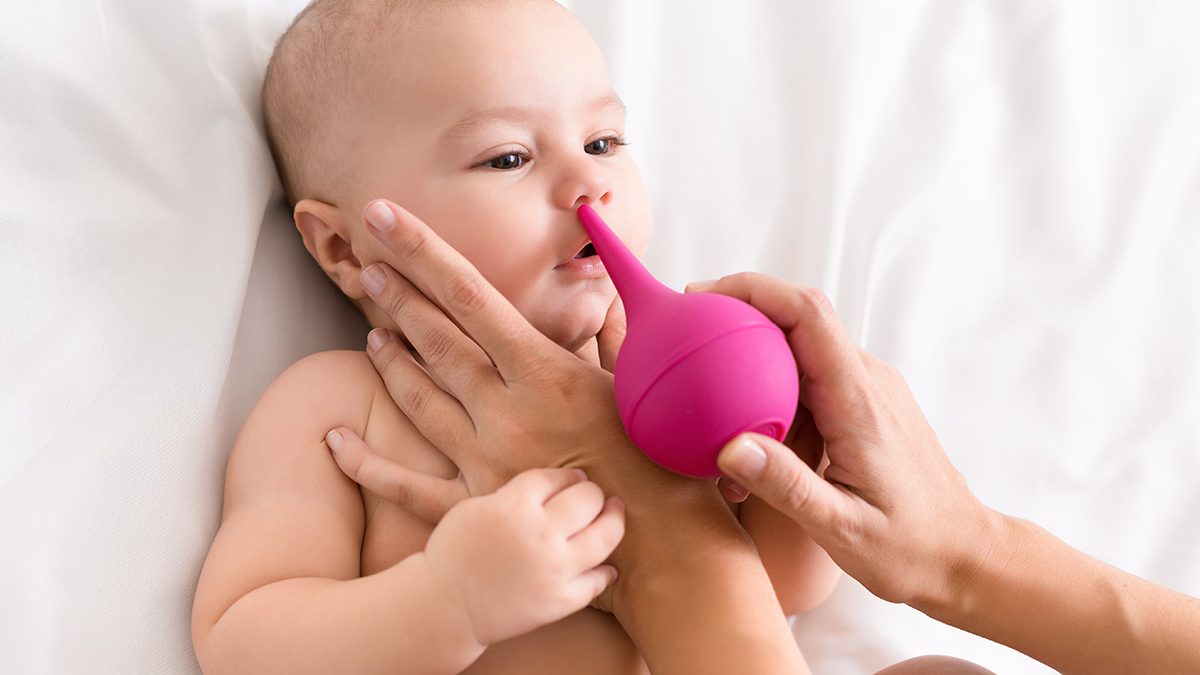 Bayi pilek
