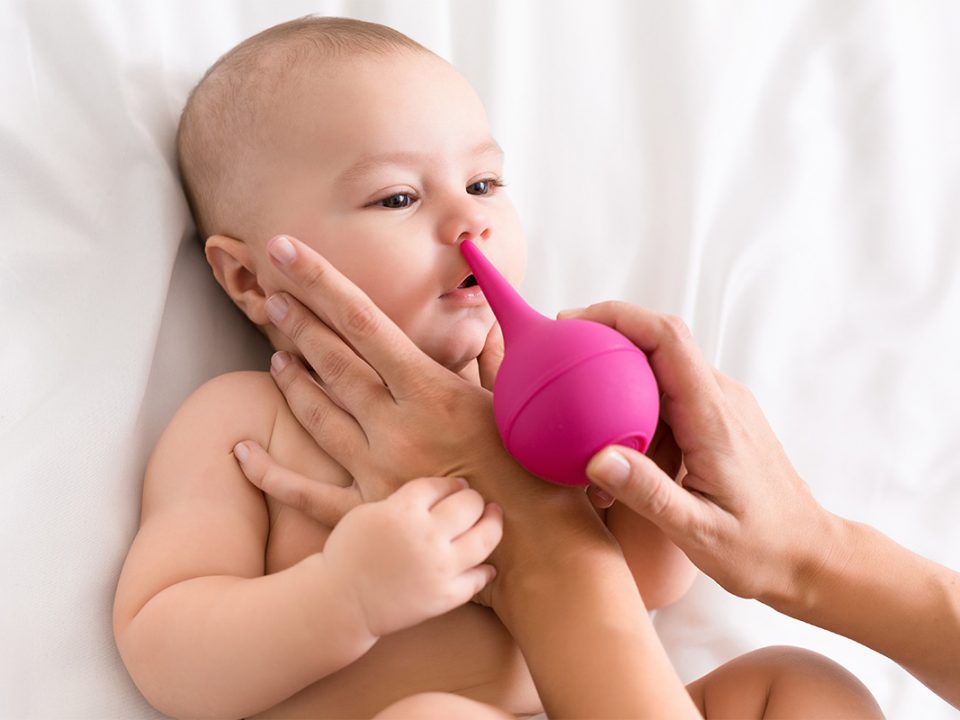 Bayi pilek