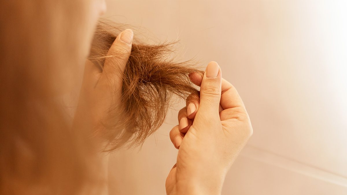Masalah rambut