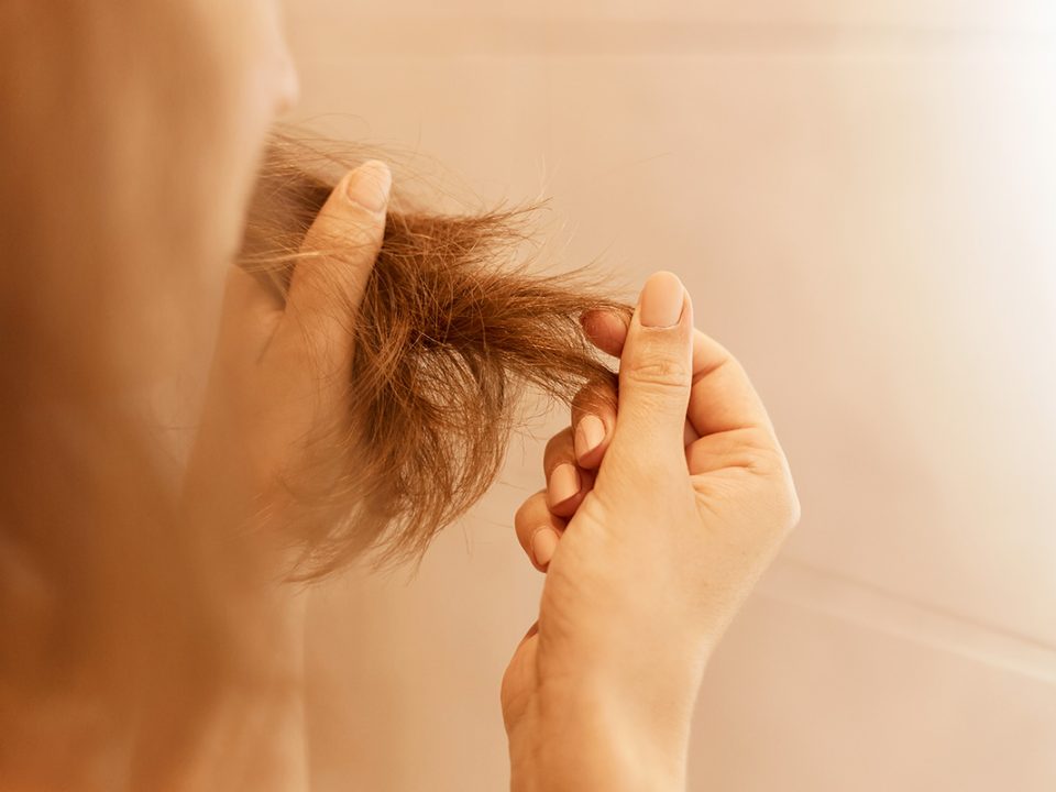 Masalah rambut
