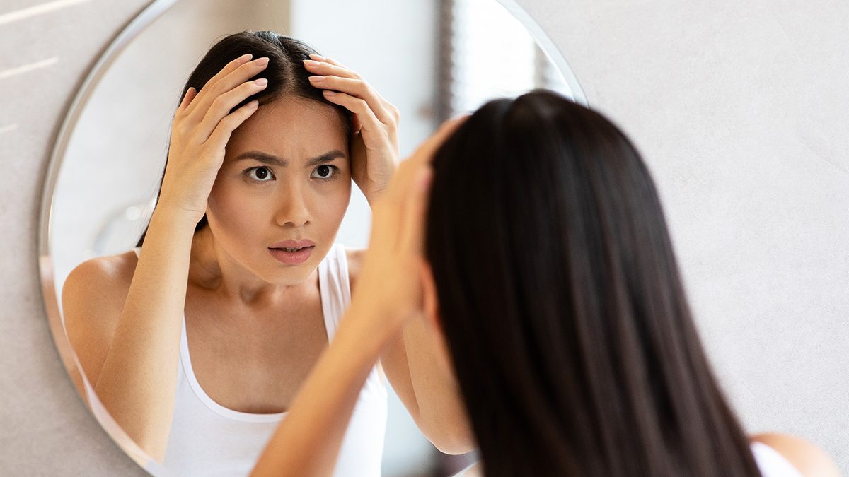 Menumbuhkan Rambut Botak