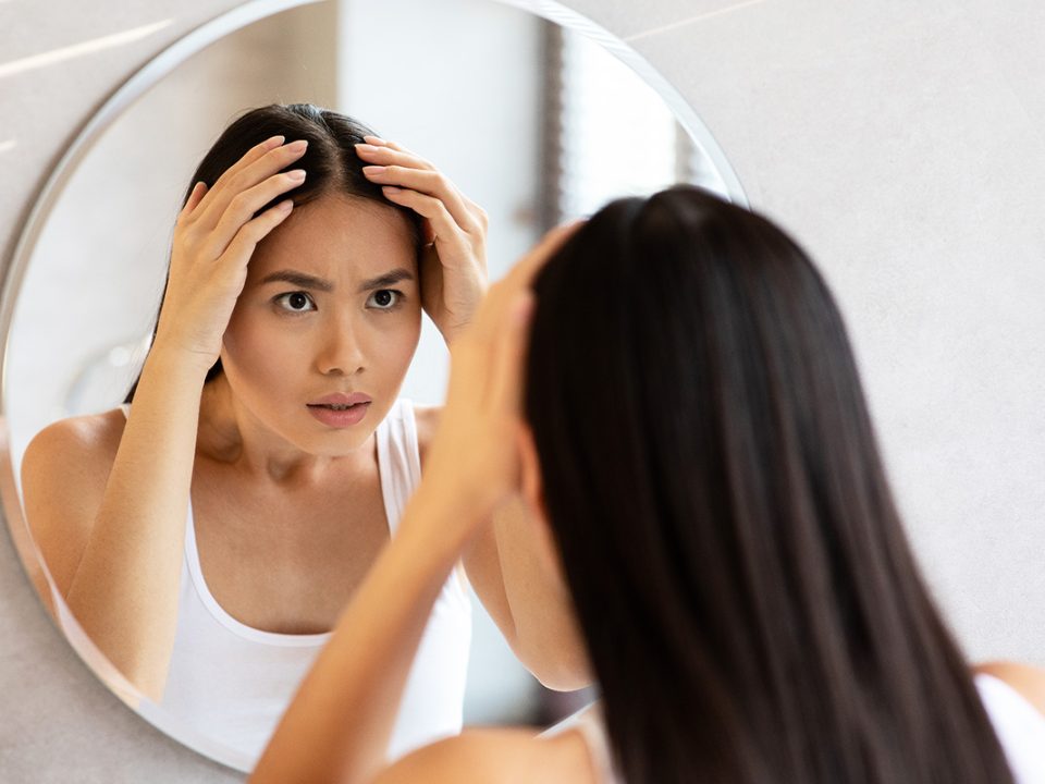 Menumbuhkan Rambut Botak