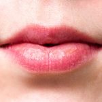 penyebab bibir kering