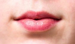 penyebab bibir kering