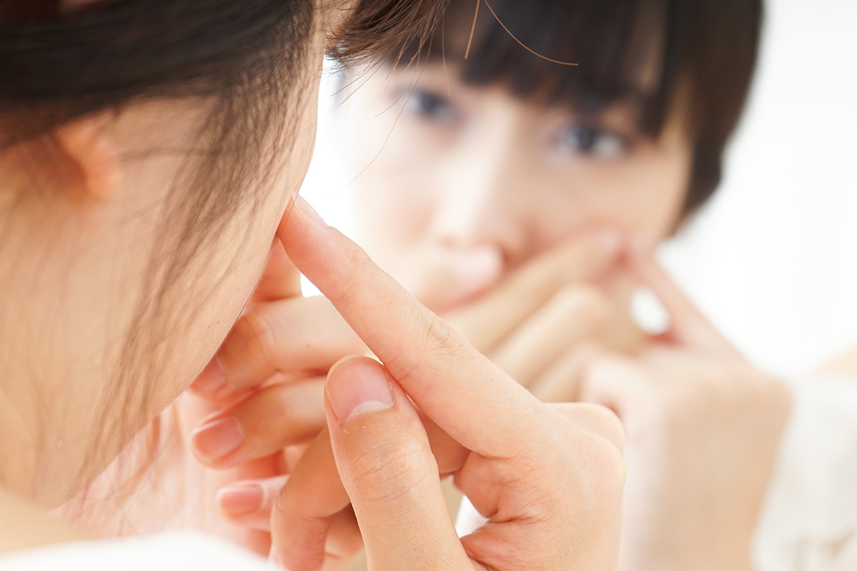 Cara menyamarkan jerawat dengan makeup