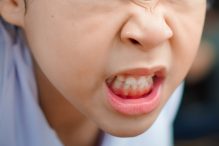 Cara mengatasi anak suka menggigit