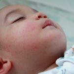 Mangatasi biang keringat pada bayi