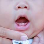 Bayi tumbuh gigi
