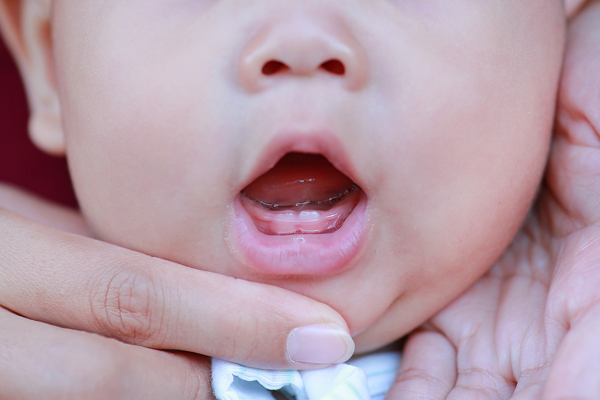 Bayi tumbuh gigi