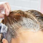Setelah Bleaching