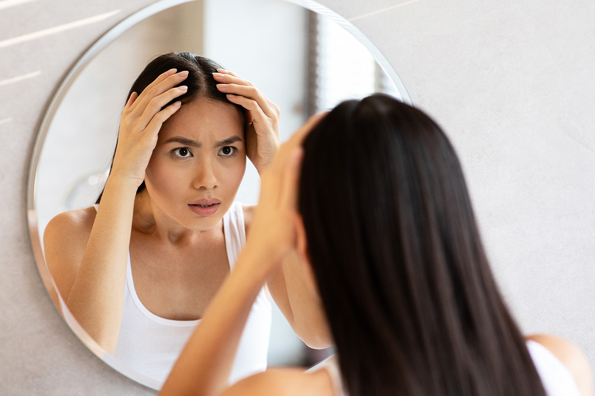 Menumbuhkan Rambut Botak