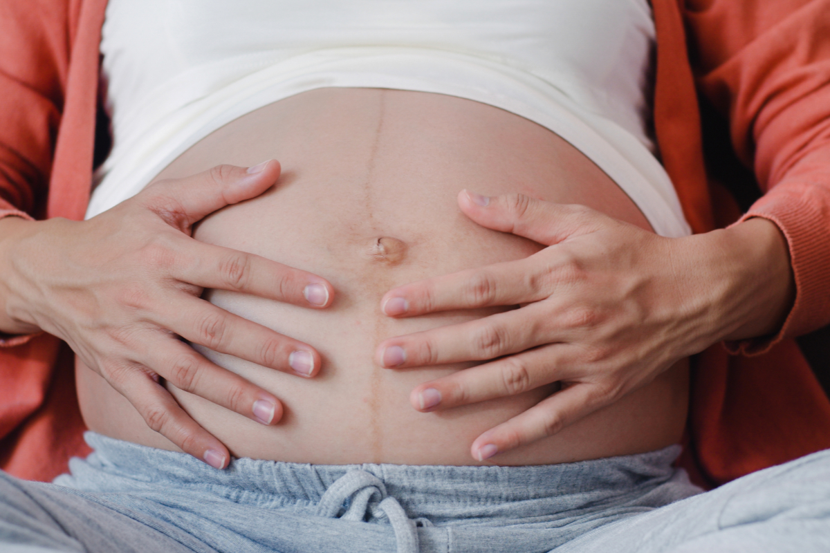 Penyebab Stretch Mark
